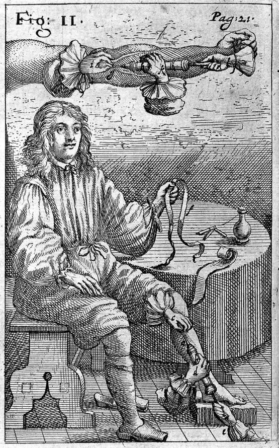 Stara rycina przedstawia młodego mężczyznę ubranego w strój historyczny siedzącego na krześle,  obok okrągłego stołu na którym znajdują się różne przedmioty. Nad mężczyzną rysunek ręki, która jest przecięta i do której wkłuwa się igła. Jedna z nóg mężczyzny oparta jest na klocku. Widzimy dwie ręce, które trzymają strzykawkę z igłą i wkłuwają się w jego nogę. 